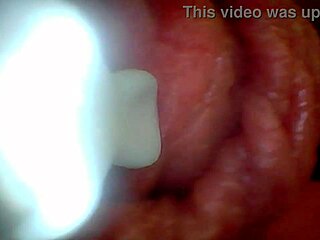 endoscope camera shows the most sensitive parts of the penis in this educational video