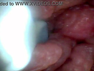 endoscope camera shows the most sensitive parts of the penis in this educational video